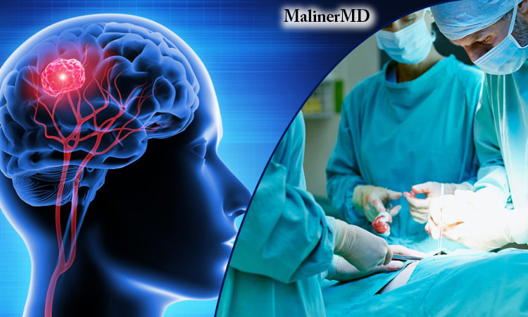 Brain Surgery Doctor in Florida